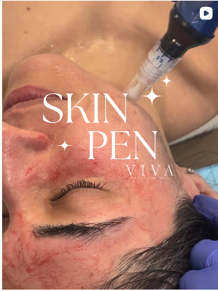 Insta Feed viva_wellnesss