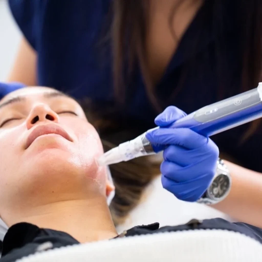 SkinPen-Microneedling-viva-medspa-in-Cranston-RI