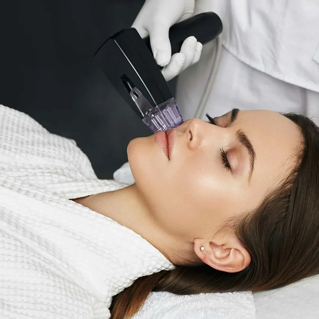 morpheus8-RF-Microneedling-viva-medspa-in-Cranston-RI